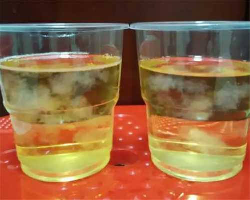 2026女性月经失调深度解析：月经周期异常如何影响高龄生子与助孕计划？